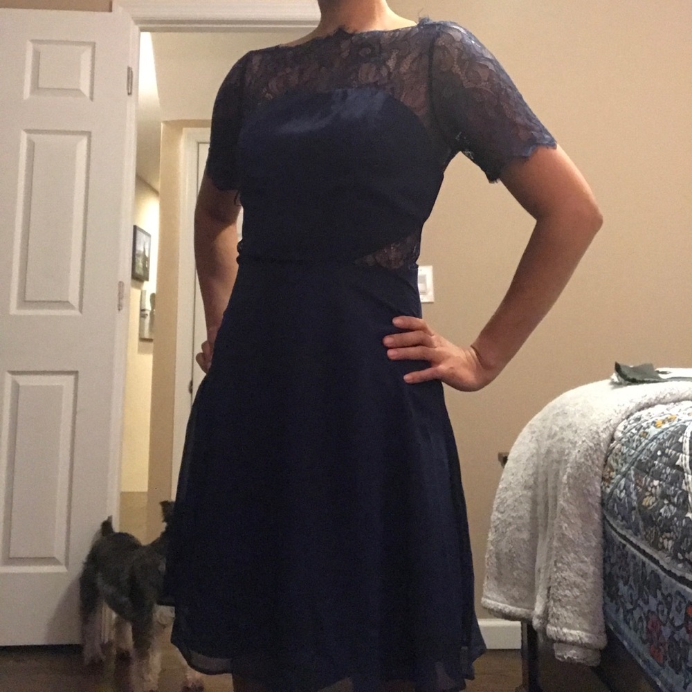 Asos Cocktail Dress